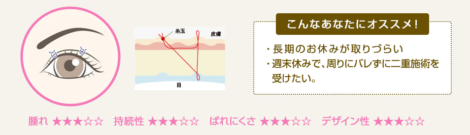 こんなあなたにオススメ！ ・長期のお休みがとりづらい・週末休みで、周りにバレずに二重施術を受けたい。