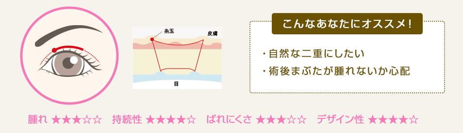 こんなあなたにオススメ！ ・自然な二重にしたい・術後まぶたが腫れないか心配