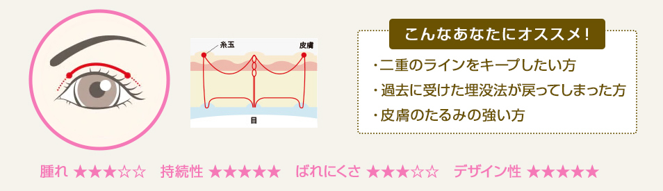 こんなあなたにオススメ！ ・二重のラインをキープしたい方・過去に受けた埋没法が戻ってしまった方・皮膚のたるみの強い方