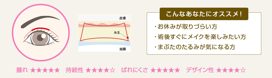 こんなあなたにオススメ！ ・お休みがとりづらい方・術後すぐにメイクを楽しみたい方・まぶたのたるみが気になる方
