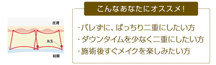 こんなあなたにオススメ！ ・バレずに、ぱっちり二重にしたい方 ・ダウンタイムを少なく二重にしたい方 ・施術後すぐメイクを楽しみたい方