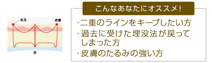 こんなあなたにオススメ！ ・二重のラインをキープしたい方・過去に受けた埋没法が戻ってしまった方・皮膚のたるみの強い方