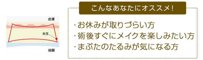 こんなあなたにオススメ！ ・お休みがとりづらい方・術後すぐにメイクを楽しみたい方・まぶたのたるみが気になる方