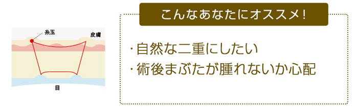 こんなあなたにオススメ！ ・自然な二重にしたい・術後まぶたが腫れないか心配