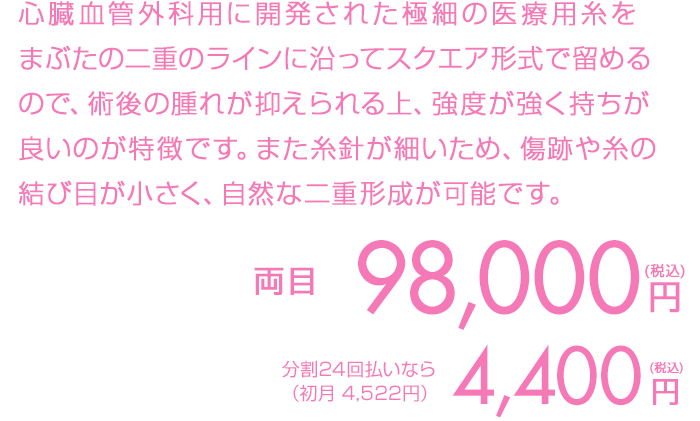 両目2点 59,000円（税込）両目3点 88,000円（税込）